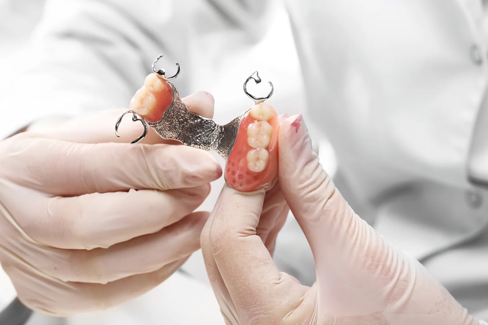 Restoring Smiles with Partials in Houston, TX: A Comprehensive Guide to Dental Health