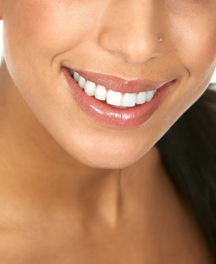 Achieve a Brighter Smile with Professional Teeth Whitening in Houston, TX